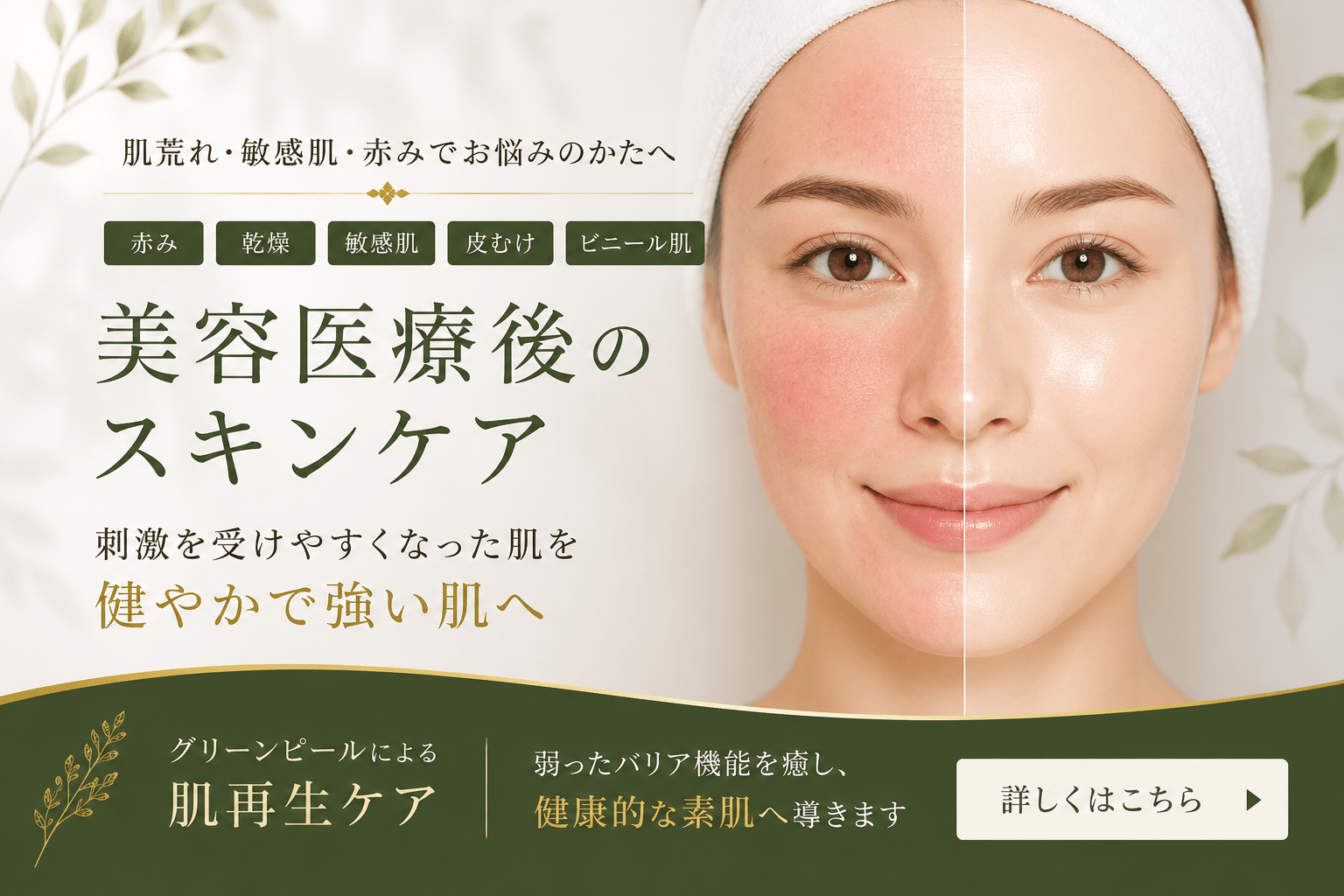グリーンピールホームケア・効果を最大限に高める4点セットの使用方法