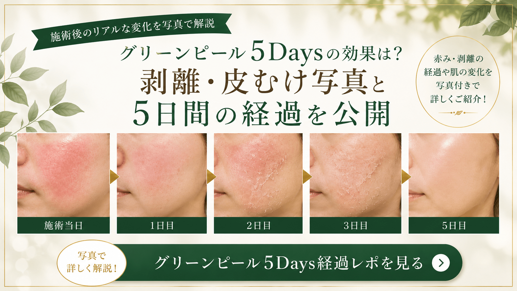 グリーンピール肌荒れ