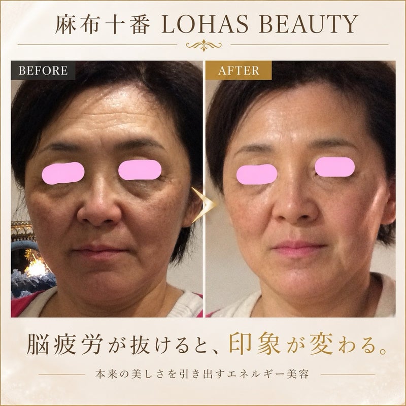 麻布十番小顔エステ・エネルギー美容・ビフォーアフター